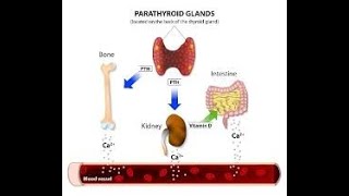 Hiperparatiroidismo [upl. by Fifine879]