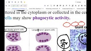 pathology  chronic inflammation [upl. by Ardnikal]