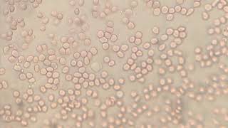 Crawling amoeboid movement white blood cells leukocytes [upl. by Annaerdna]