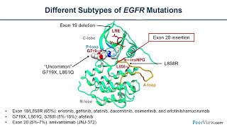 Testing for Common and Uncommon EGFR Mutations to Guide EGFRTargeted Therapy in NSCLC [upl. by Hose]