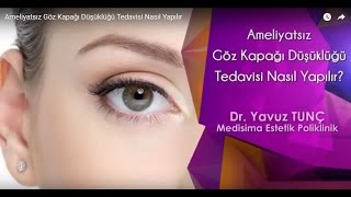 Ameliyatsız Göz Kapağı Düşüklüğü Tedavisi Nasıl Yapılır [upl. by Viddah]