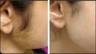 Rica wax tutorial  face wax Rica wax use for face hair remove [upl. by Hseyaj]