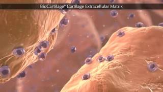 BioCartilage® Cartilage Extracellular Matrix [upl. by Viscardi]