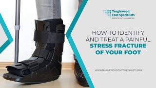 How to Identify and Treat a Painful Stress Fracture of Your Foot [upl. by Klusek199]