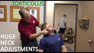 EXTREME neck pain amp TORTICOLLIS are GONE with HUGE NECK ADJUSTMENTs SoCalChiropractic [upl. by Vida]