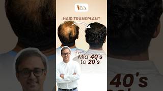 Get YoungerLooking Hair in Just Few Months  Dr Deepam Shah shorts trending hairtransformation [upl. by Kamaria]