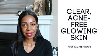 My Skincare Routine For Clear AcneFree Skin [upl. by Sirej519]