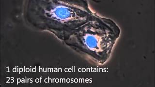 A microscopic view of a buccal swab sample for DNA analysis [upl. by Lidda]