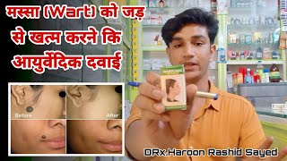 Wartosin Wart Remover  how to remove warts from skin [upl. by Can350]