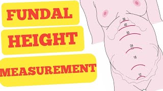 symphysis fundal height measurement  gestational age measurement [upl. by Auhsaj]