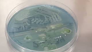 Lactose fermenting colonies of Raoultella ornithinolytica became Nonlactose fermenting after old [upl. by Lolly]