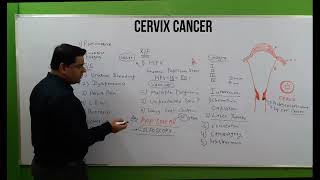 Cervix Cancer Hindi  NCLEX  Symptoms of cervix cancer  Types  Treatment  Nursing Consideration [upl. by Abehsat269]