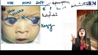 One shot ophthalmology for neet pg  inicetbuphthalmos [upl. by Davilman]