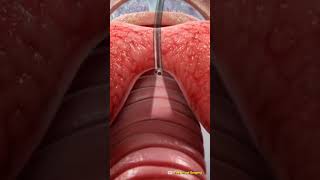 Bronchoscopy 3D Animation lungs bronchoscopy medical [upl. by Uela]