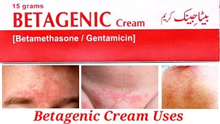 Betagenic Cream Uses in Urdu Hindi [upl. by Asseral]