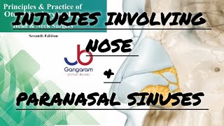 Nose and Paranasal Sinuses Injuries PART1  Key Insights from ENT [upl. by Laveen]