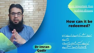 Important information for scabies treatment  خارش کی بیماری میں کیا اہم ہے؟ Dr imran Qadir [upl. by Rodrigo]