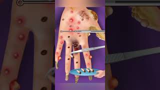 ASMR 131124 Hand Treatment Part5 asmr satisfying relaxing relax cleaning remove animation [upl. by Nagiam]