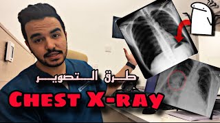 شرح كامل لوضعيات Chest Xray 🫁 [upl. by Anyak]