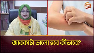 জারকাটা ভালো হবে কীভাবে  Keratosis pilaris  Channel 24 [upl. by Eelaras583]