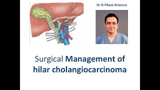 Surgical management of Hilar cholangiocarcinoma  Phani Krishna Ravula [upl. by Araj809]