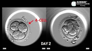 IVF timelapse imaging  Sunway Fertility Centre [upl. by Latsirc]