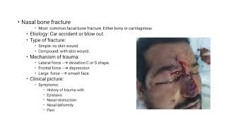 Choanal Atresia Oroantral Festula CSF Rhinorrhea Septal Hematoma Septal Abscess د ناصر العزيب [upl. by Sirois710]