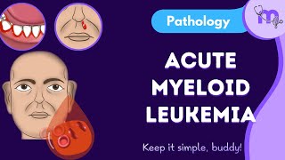 Acute Myeloid leukemia General pathology Examination Diagnosis Classification  Treatment [upl. by Strawn]