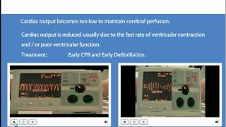 Advanced Life Support Shockable and Non Shockable Rhythms [upl. by Dorweiler]