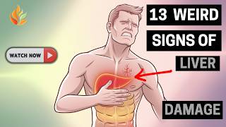 13 Early Warning Signs of Liver Damage You Should Not Ignore [upl. by Funk]