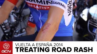 How To Treat Road Rash  Vuelta A España 2014 [upl. by Brigitta530]