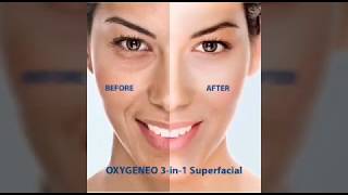 OxyGeneo 3in1 Super Facial Machine [upl. by Graff]