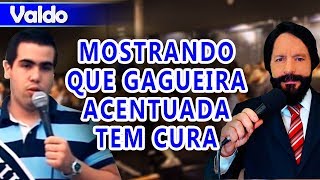 Valdo mostra que a gagueira acentuada tem cura [upl. by Bernard]