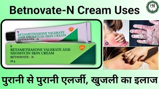 BetnovateN Cream Uses in Hindi  BetnovateN benefits  Skin infection  Psoriasis  Eczema [upl. by Fira]