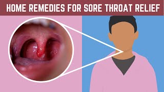 Home Remedies for Sore Throat Relief – Natural amp Effective Solutions [upl. by Aymik]