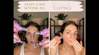 Facial Cupping Demonstration with Ashley Green Holistic Esthetician [upl. by Beckie]