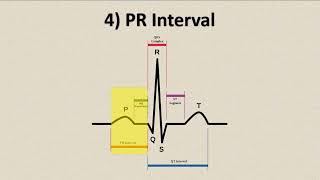 Medic Minute  ECG Interpretation [upl. by Anaitsirc]