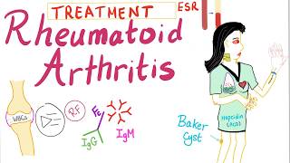 Rheumatoid Arthritis Part 10 Management Introduction [upl. by Nikolos994]