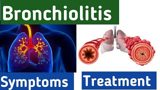 Bronchiolitis breathing  bronchiolitis cough symptoms causes diagnosis and treatment bronchitis [upl. by Alitta123]