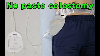 How to use urostomy bag one side [upl. by Ennairod]