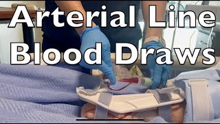 Drawing Blood from an Arterial Line [upl. by Trina]