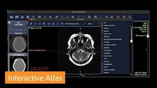 Your Customizable Tool for Medical Imaging  IMV DICOM Viewer [upl. by Phia]