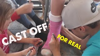 CAST COMES OFF PERMANENTLY FOR TEN YEAR OLD WHO HAD MAJOR SURGERY  NO MORE CAST FOREVER [upl. by Nnylecyoj]