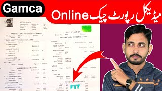 Gamca medical report check onlineHow to check gamca medical report onlineMedical check online [upl. by Adin]