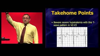 EEM 2019 Hypokalemia You thought you knew how to recognize it [upl. by Ekard525]