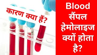 blood sample hemolyzed Kyun hota hai  hemolyzed serum sample in hindi [upl. by Animaj528]