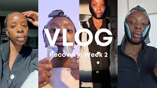 VLOG 14 Week 2 After Double Jaw Surgery  I CAN TALK Splint Removal iMac Unboxing amp More [upl. by Aicinat]