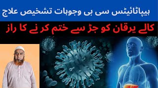 Kaly Yarkan Ka Ilaj Desi In UrduHindi  How To Treat Hepatitis B amp C Cure  Kaly Yarkan Ka Wazifa [upl. by Ahsatin]