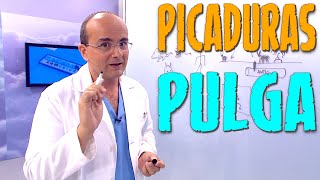 PICADURA DE PULGA ¿Cómo son ¿Qué síntomas producen ¿Cómo hay que actuar ¿Cómo Prevenirlas [upl. by Anderer]