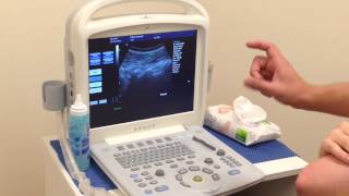 Real Time Ultrasound Rehabilitation of Multifidus [upl. by Aken]